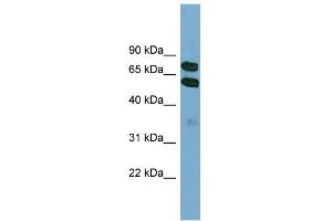 WB Suggested Anti-KLHL9 Antibody Titration: 0. (KLHL9 antibody  (Middle Region))