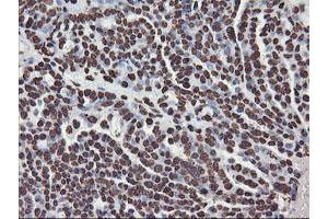 Image no. 12 for anti-F-Box Protein 21 (FBXO21) antibody (ABIN1498233) (FBXO21 antibody)