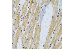 Immunohistochemistry (Paraffin-embedded Sections) (IHC (p)) image for anti-Adrenergic, Beta, Receptor Kinase 1 (ADRBK1) (AA 440-689) antibody (ABIN3022346)