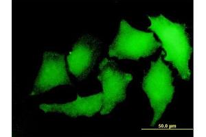 Immunofluorescence of monoclonal antibody to S100A2 on HeLa cell. (S100A2 antibody  (AA 1-97))