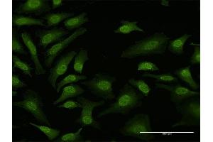 Immunofluorescence of purified MaxPab antibody to TPRKB on HeLa cell. (TPRKB antibody  (AA 1-175))