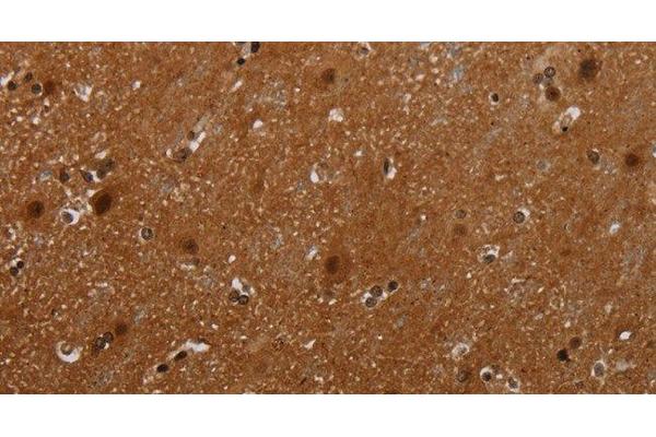 MAGEB18 antibody