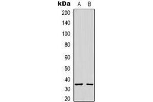 Western blot analysis of Syntaxin 1A expression in A431 (A), K562 (B) whole cell lysates. (STX1A antibody)