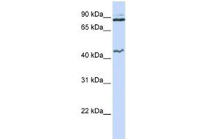 WB Suggested Anti-MCM9 Antibody Titration:  0. (MCM9 antibody  (N-Term))