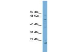 Image no. 1 for anti-Cytochrome P450, Family 2, Subfamily R, Polypeptide 1 (CYP2R1) (AA 179-228) antibody (ABIN6746310) (CYP2R1 antibody  (AA 179-228))