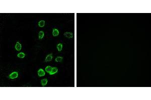 Peptide - +Immunohistochemistry analysis of paraffin-embedded human pancreas tissue using ATP5G3 antibody. (ATP5G3 antibody)