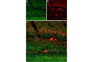 Expression of SERT in mouse brain - Immunohistochemical staining of immersion-fixed, free floating mouse brain frozen sections using Anti-Serotonin Transporter (SERT) (extracellular) Antibody (ABIN7043745, ABIN7044608 and ABIN7044609), (1:400). (SLC6A4 antibody  (4th Extracellular Loop))
