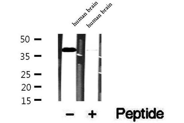Tropomodulin 4 antibody  (Internal Region)