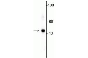 Western blot of HeLa lysate showing specific immunolabeling of the ~49 kDa SAP49 protein. (SF3B4 antibody)