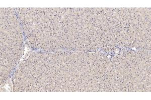 Immunohistochemistry (IHC) image for anti-serpin Peptidase Inhibitor, Clade B (Ovalbumin), Member 4 (SERPINB4) (AA 144-298) antibody (ABIN7425743)