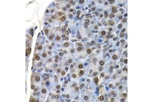 Immunohistochemistry of paraffin-embedded mouse pancreas using ID3 antibody (ABIN6130481, ABIN6142140, ABIN6142141 and ABIN6221020) at dilution of 1:200 (40x lens). (ID3 antibody  (AA 1-119))