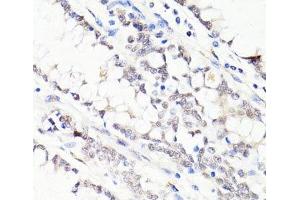 Immunohistochemistry of paraffin-embedded Human colon using FKBP5 Polyclonal Antibody at dilution of 1:100 (40x lens).