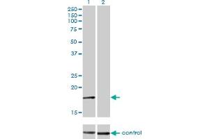Western blot analysis of AP2S1 over-expressed 293 cell line, cotransfected with AP2S1 Validated Chimera RNAi (Lane 2) or non-transfected control (Lane 1).
