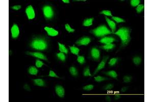Immunofluorescence of monoclonal antibody to SLC2A4RG on HeLa cell. (SLC2A4RG antibody  (AA 178-269))