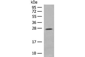 Western blot analysis of Human placenta tissue lysate using MDFI Polyclonal Antibody at dilution of 1:400 (MDFI antibody)