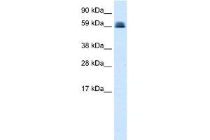WB Suggested Anti-ZNF499 Antibody Titration: 0.