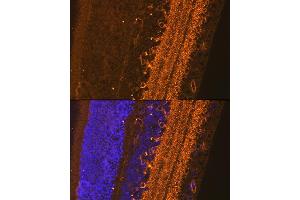 Immunofluorescence analysis of Rat eyeball using G/G/G antibody (ABIN3017018, ABIN3017019, ABIN3017020 and ABIN6219924) at dilution of 1:100. (GAD antibody  (AA 1-200))