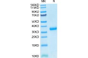 SDS-PAGE (SDS) image for SARS-CoV-2 Spike (N501Y), (RBD) protein (His tag) (ABIN7274385)