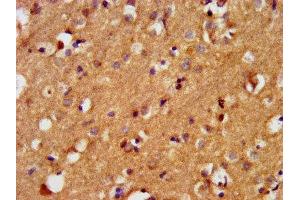 BAIAP3 antibody  (AA 131-257)