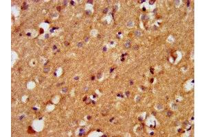 IHC image of ABIN7145227 diluted at 1:400 and staining in paraffin-embedded human brain tissue performed on a Leica BondTM system. (BAIAP3 antibody  (AA 131-257))