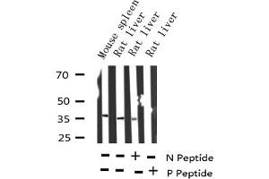 Western blot analysis of Phospho-I kappaB epsilon (Ser22) expression in various lysates