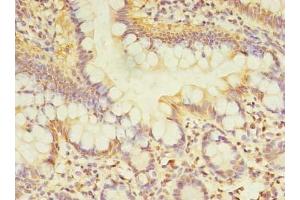 Immunohistochemistry of paraffin-embedded human small intestine tissue using ABIN7171449 at dilution of 1:100 (TCP11L2 antibody  (AA 1-210))