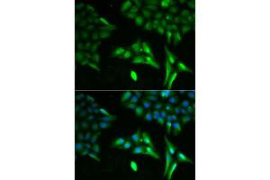 Immunofluorescence analysis of U2OS cells using ACADS antibody. (ACADS antibody)