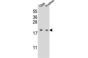 Western blot analysis of LSM7 Antibody (C-term) in CEM cell line and mouse spleen tissue lysates (35ug/lane). (LSM7 antibody  (C-Term))