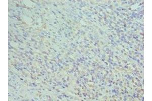 Immunohistochemistry of paraffin-embedded human epityphlon tissue using ABIN7155575 at dilution of 1:100 (CD74 antibody  (AA 137-296))
