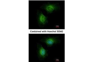 ICC/IF Image Immunofluorescence analysis of methanol-fixed HeLa, using Cytochrome P450 1B1, antibody at 1:200 dilution. (CYP1B1 antibody  (Center))