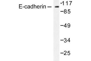 Image no. 1 for anti-Cadherin 1, Type 1, E-Cadherin (Epithelial) (CDH1) antibody (ABIN265391) (E-cadherin antibody)