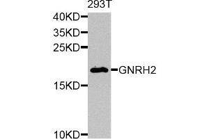 Western blot analysis of extracts of 293T cells, using GNRH2 antibody. (GnRH2 antibody)
