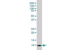 S100A6 antibody  (AA 1-90)