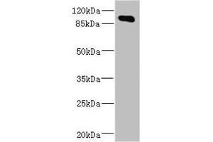Western blot All lanes: MAP4K5 antibody at 4. (MAP4K5 antibody  (AA 300-480))