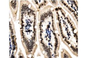 IHC analysis of HP1 alpha/CBX5 using anti-HP1 alpha/CBX5 antibody (ABIN7599058). (CBX5 antibody  (AA 1-191))