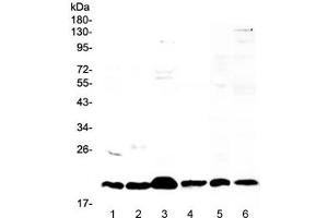 Western blot testing of 1) mouse stomach, 2) mouse spleen, 3) mouse thymus, 4) mouse small intestine, 5) rat thymus and 6) human placental lysate with ICOS antibody at 0. (ICOS antibody)