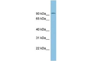 WB Suggested Anti-TLK1 Antibody Titration: 0. (TLK1 antibody  (Middle Region))