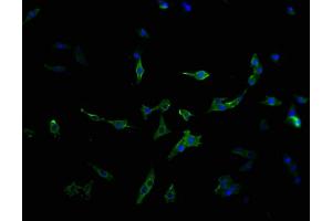 Immunofluorescence staining of MCF-7 cells with ABIN7159373 at 1:100, counter-stained with DAPI. (MBTPS1 antibody  (AA 187-400))