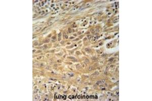 Immunohistochemistry (IHC) image for anti-Cyclin M4 (CNNM4) antibody (ABIN3002338)