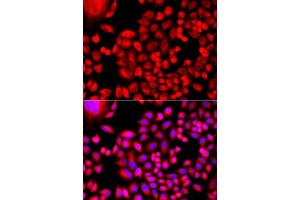 Immunofluorescence analysis of A549 cells using MTHFD1L antibody. (MTHFD1L antibody  (AA 759-978))