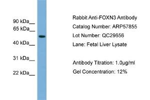 WB Suggested Anti-FOXN3  Antibody Titration: 0. (FOXN3 antibody  (Middle Region))