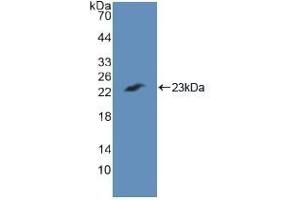 Detection of Recombinant CASP7, Human using Polyclonal Antibody to Caspase 7 (CASP7) (Caspase 7 antibody  (AA 24-198))