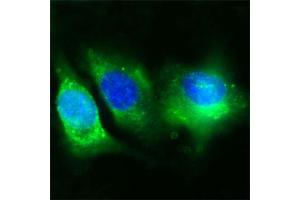 Human Melanoma cell line C 32 was cultured overnight on round cover slides placed in a 24 well tissue culture plate.