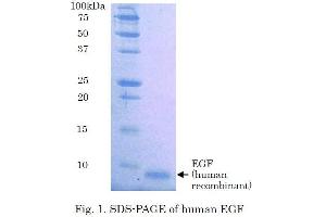 SDS-PAGE (SDS) image for Epidermal Growth Factor (EGF) (Active) protein (ABIN2452188) (EGF Protein)
