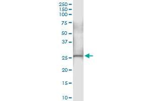 Immunoprecipitation (IP) image for anti-NADH Dehydrogenase (Ubiquinone) Fe-S Protein 3, 30kDa (NADH-Coenzyme Q Reductase) (NDUFS3) (AA 1-264) antibody (ABIN518253)