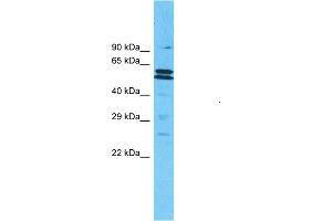 Host:  Rabbit  Target Name:  MLLT3  Sample Type:  721_B Cell lysates  Antibody Dilution:  1. (AF9 antibody  (N-Term))