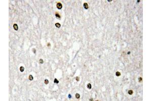 Immunohistochemical analysis of paraffin-embedded human brain tissue using TP73 polyclonal antibody . (Tumor Protein p73 antibody)