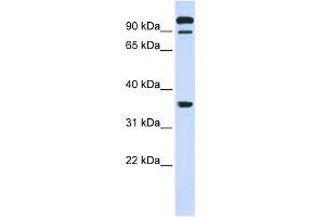 WB Suggested Anti-PTPRE Antibody Titration:  0. (PTPRE antibody  (Middle Region))