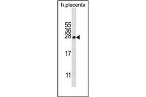 Western blot analysis of Beta-crystallin A3 Antibody  in human placenta tissue lysates (35ug/lane).