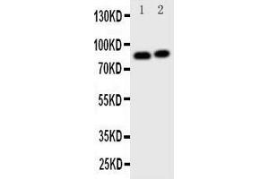 Western Blotting (WB) image for anti-Gelsolin (GSN) (AA 763-775), (C-Term) antibody (ABIN3043978)